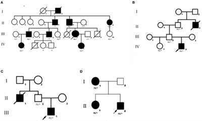 Phenotypic and Genotypic Characterization of DEPDC5-Related Familial Focal Epilepsy: Case Series and Literature Review